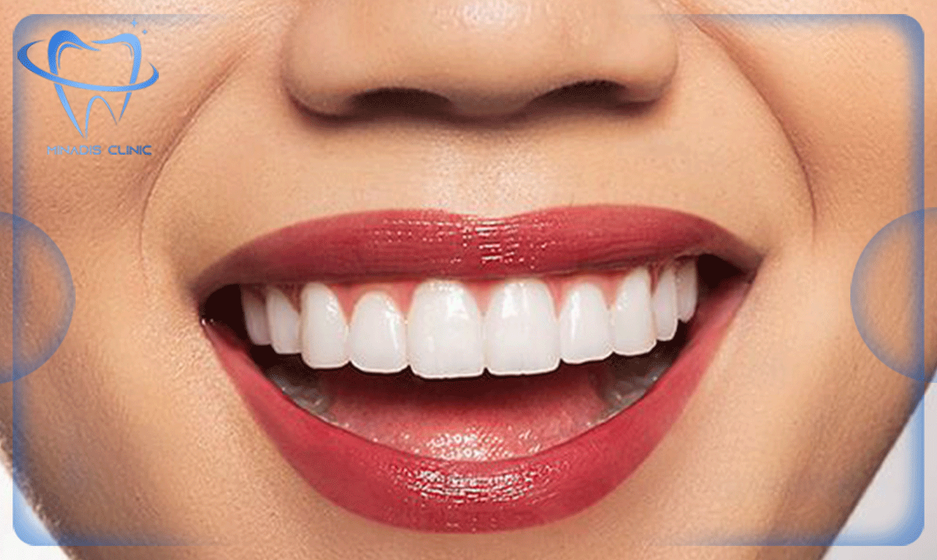 دندانپزشکی زیبایی در گیشا