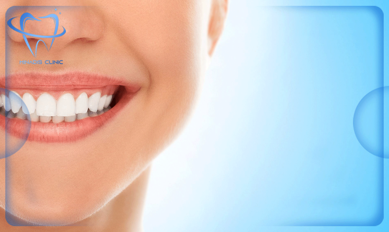 سفید کردن دندان و دندانپزشکی زیبایی