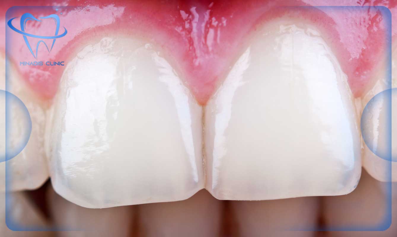 اهمیت بهداشت دهان و دندان