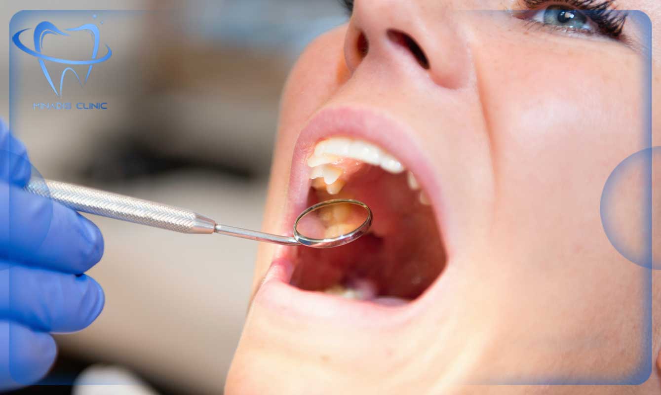 اهمیت ویزیت دندانپزشکی